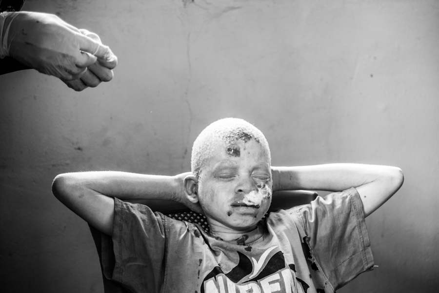 Albinos Africa, ghost people.