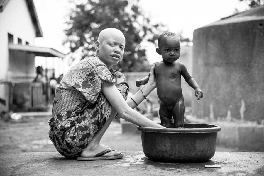 Albinos Africa, ghost people.