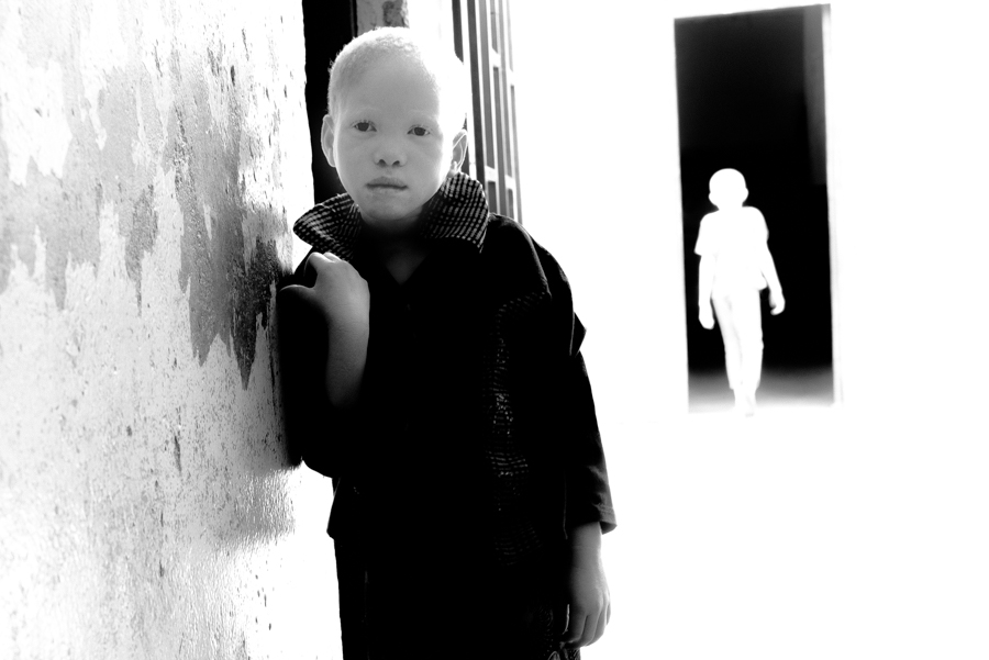 Albinos Africa, ghost people.
