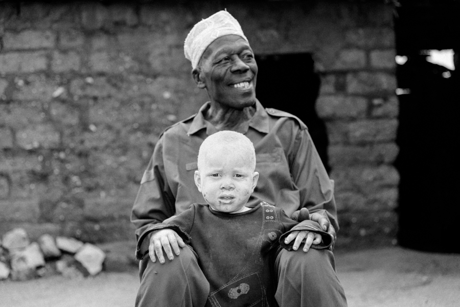 Albinos Africa, ghost people.