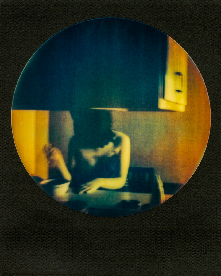 Prosopagnosia