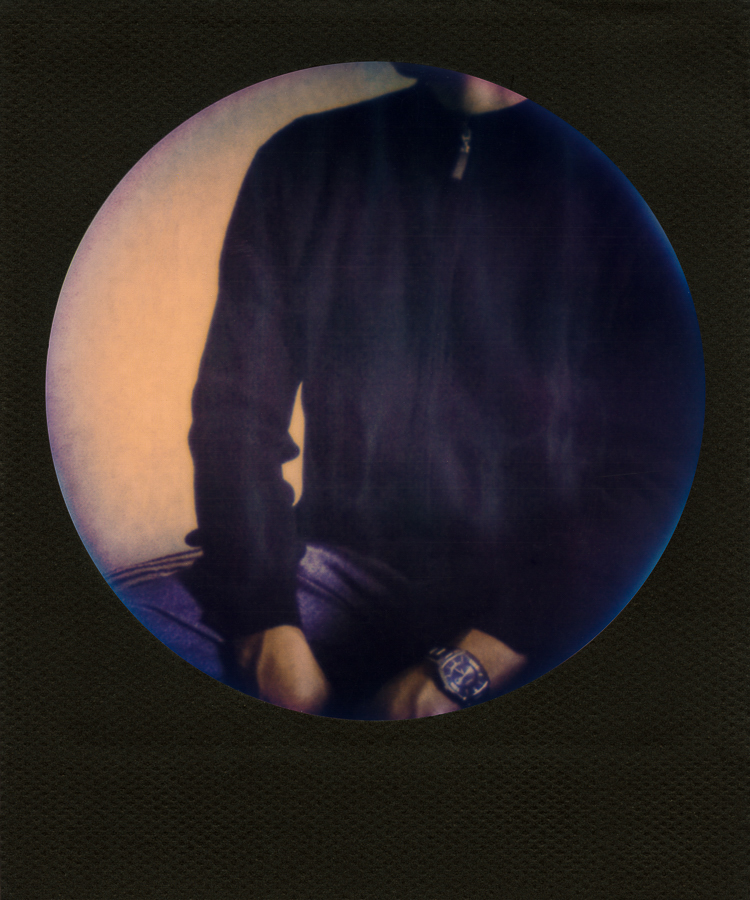 Prosopagnosia