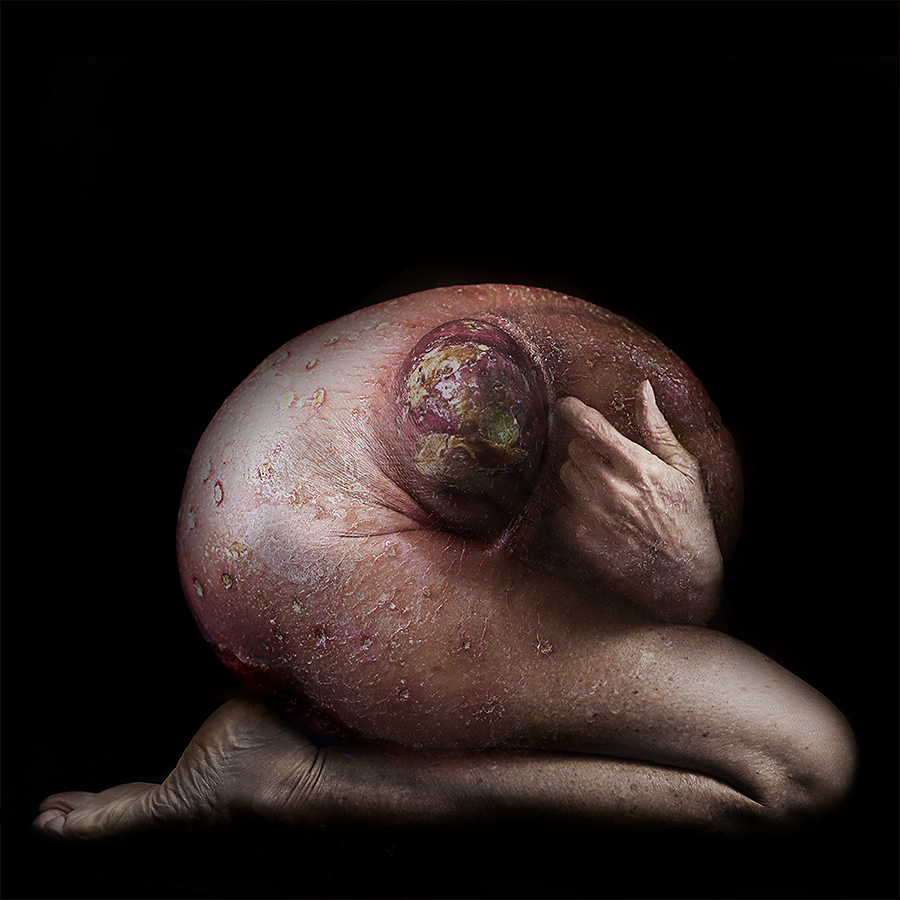 Embryo