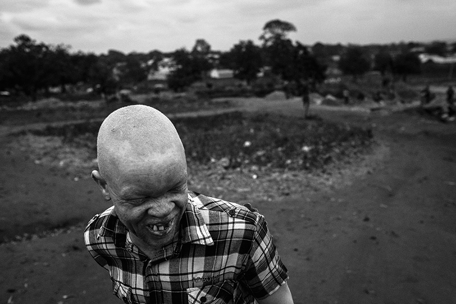 Albinos
