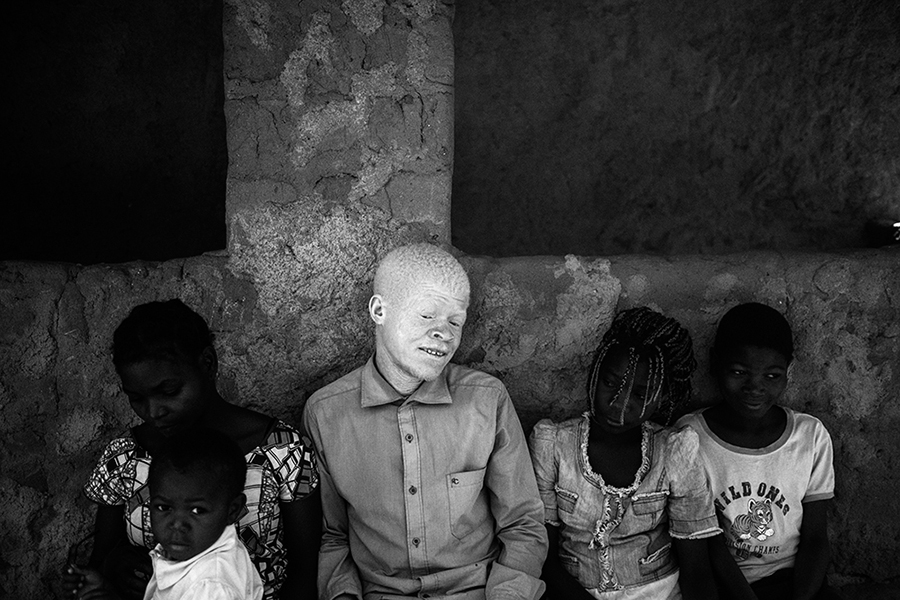 Albinos