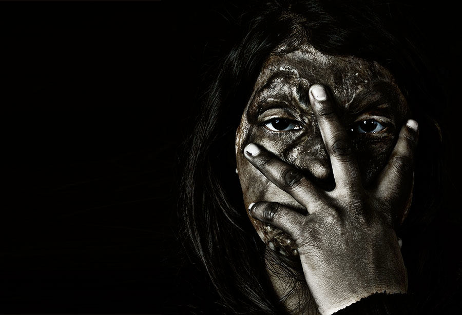 Emotional Scars - The Emotional Journey of Acid Attack Survivors !