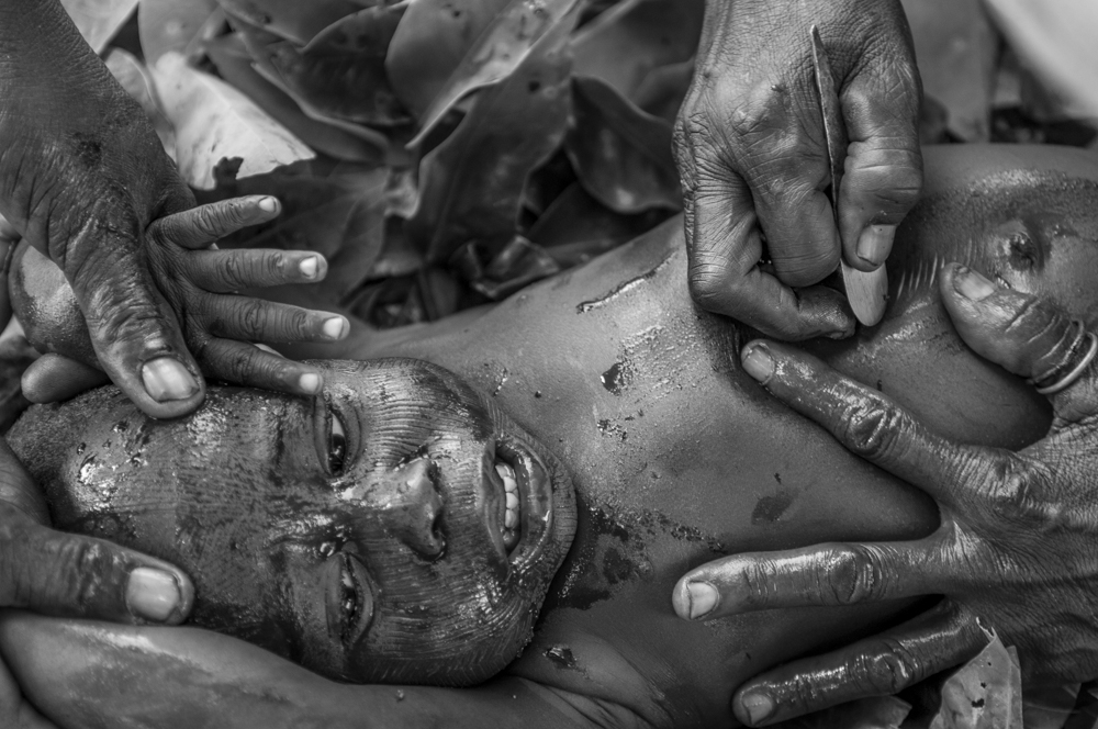 Scarification