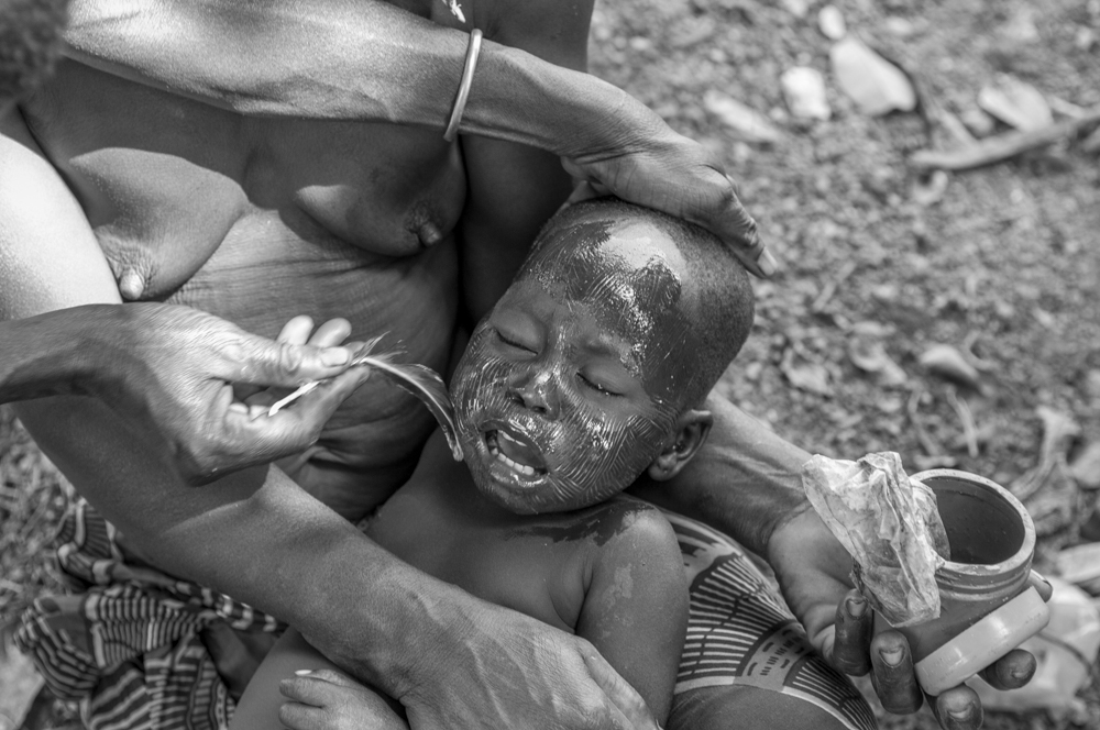 Scarification