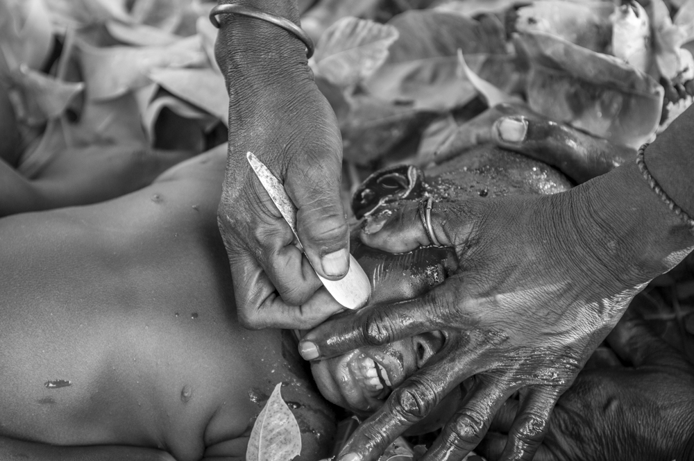 Scarification