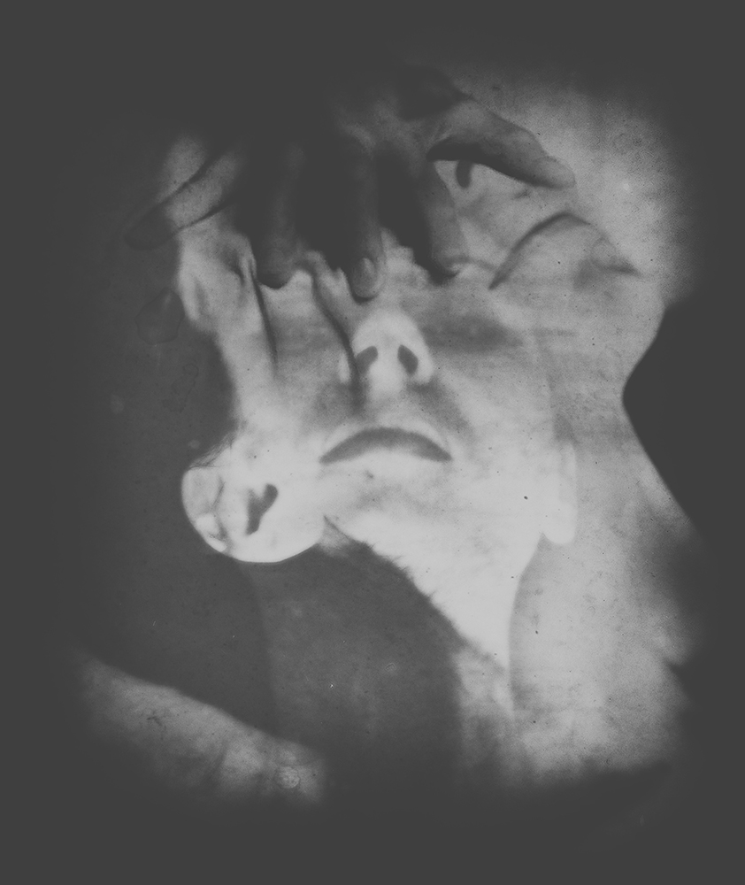 Depression