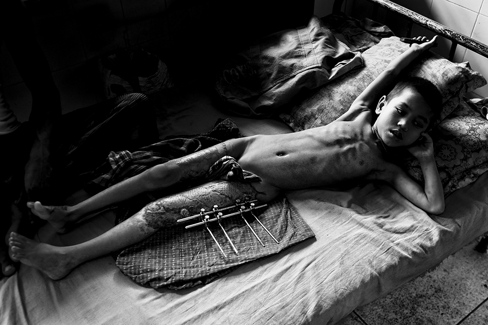 I am Rohingya