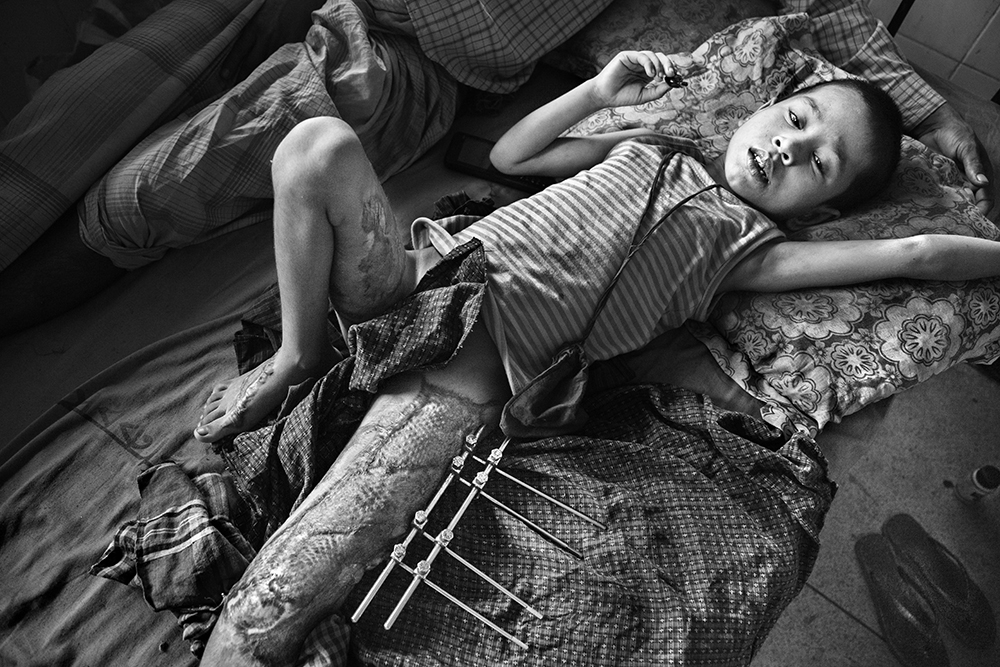 Rohingya Refugee Crisis 