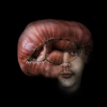 Embryo