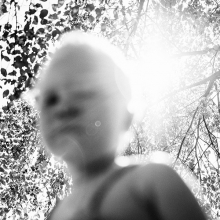 Albinos