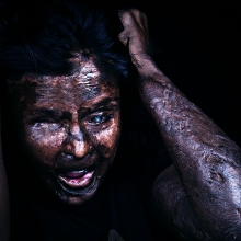 Emotional Scars - The Emotional Journey of Acid Attack Survivors !