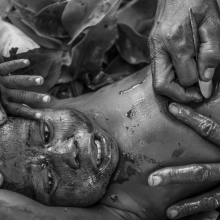 Scarification
